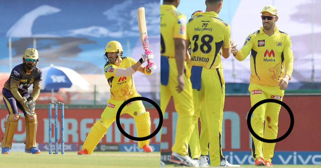 Watch Faf du Plessis Bats On With A Bleeding Knee As CSK March On To