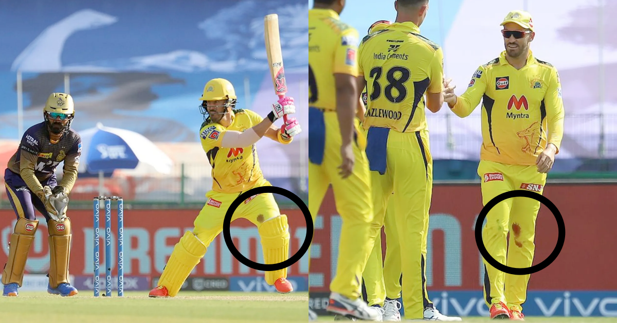 Faf du Plessis Bleeding Knee CSK KKR